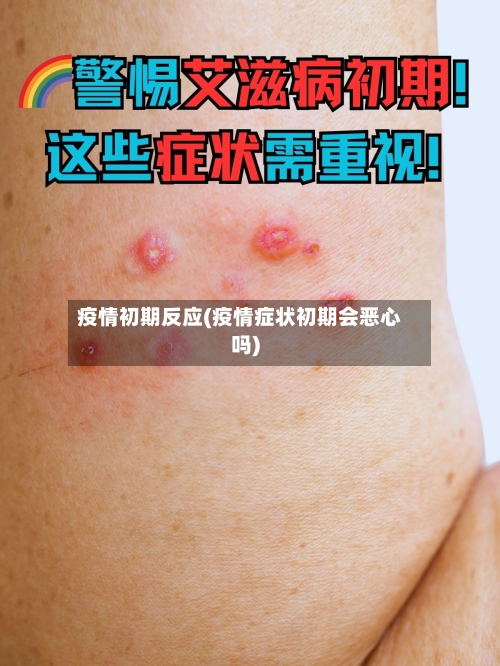 疫情初期反应(疫情症状初期会恶心吗)