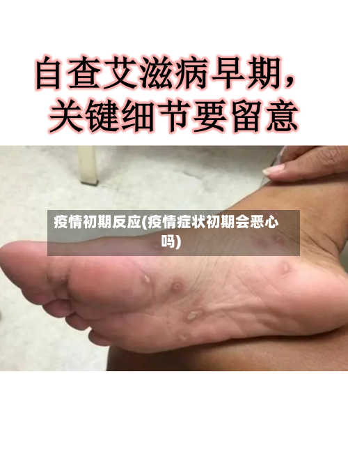 疫情初期反应(疫情症状初期会恶心吗)-第2张图片